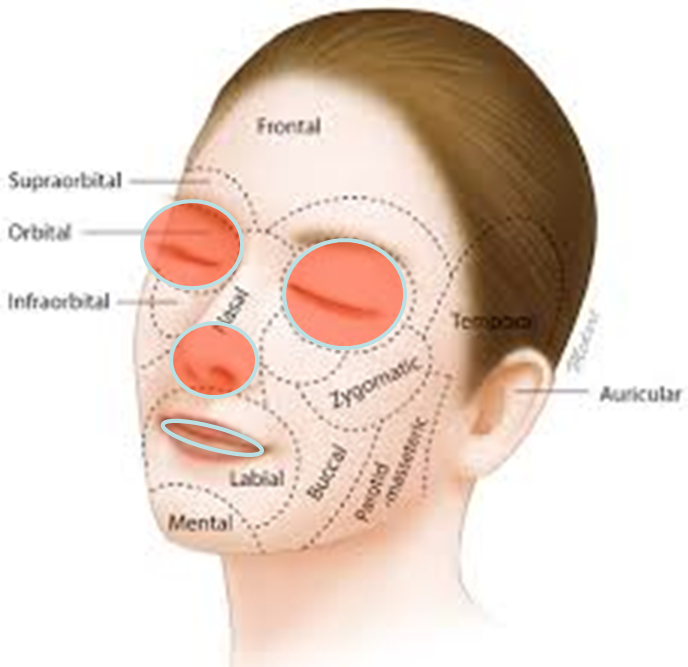 esthetic facial units