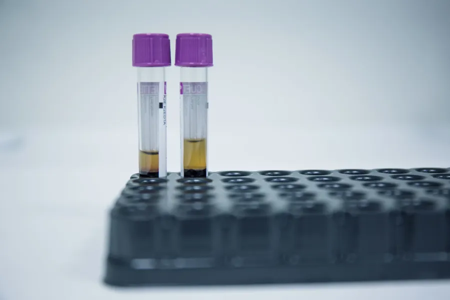 Bilde av to beholdere med væske i