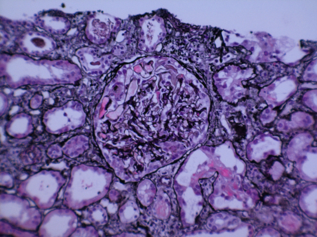 A close up of a microscopic image