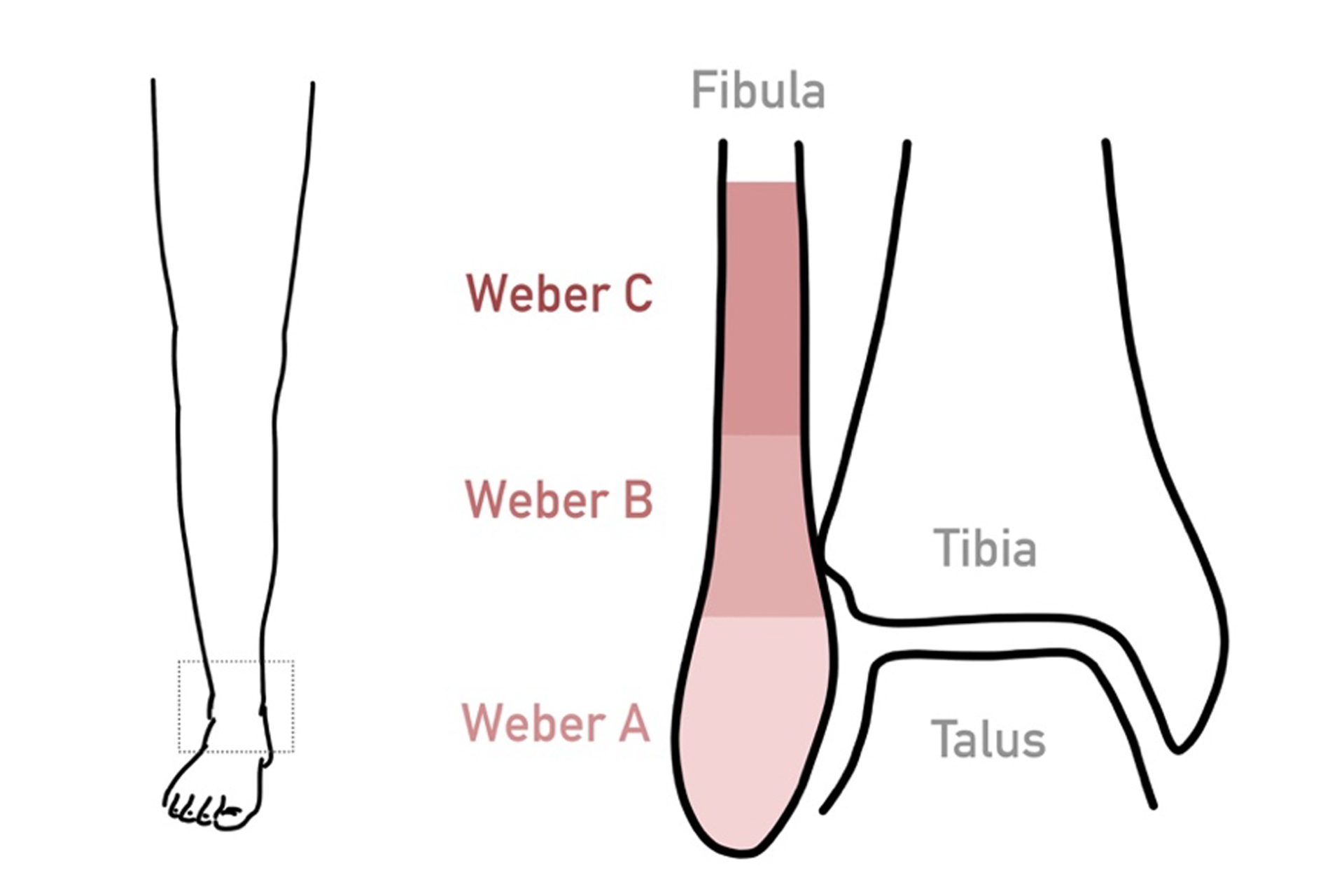 weber