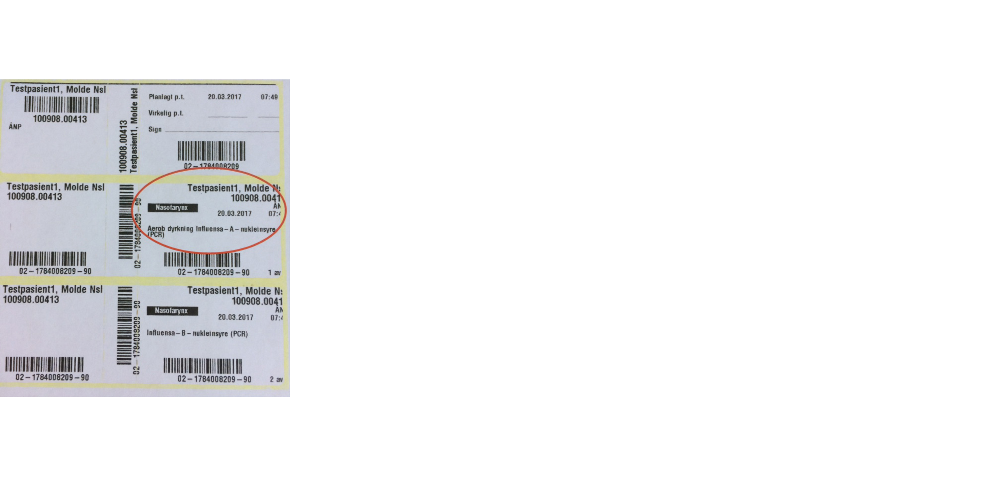 Eksempel på etikett for en luftveisprøve