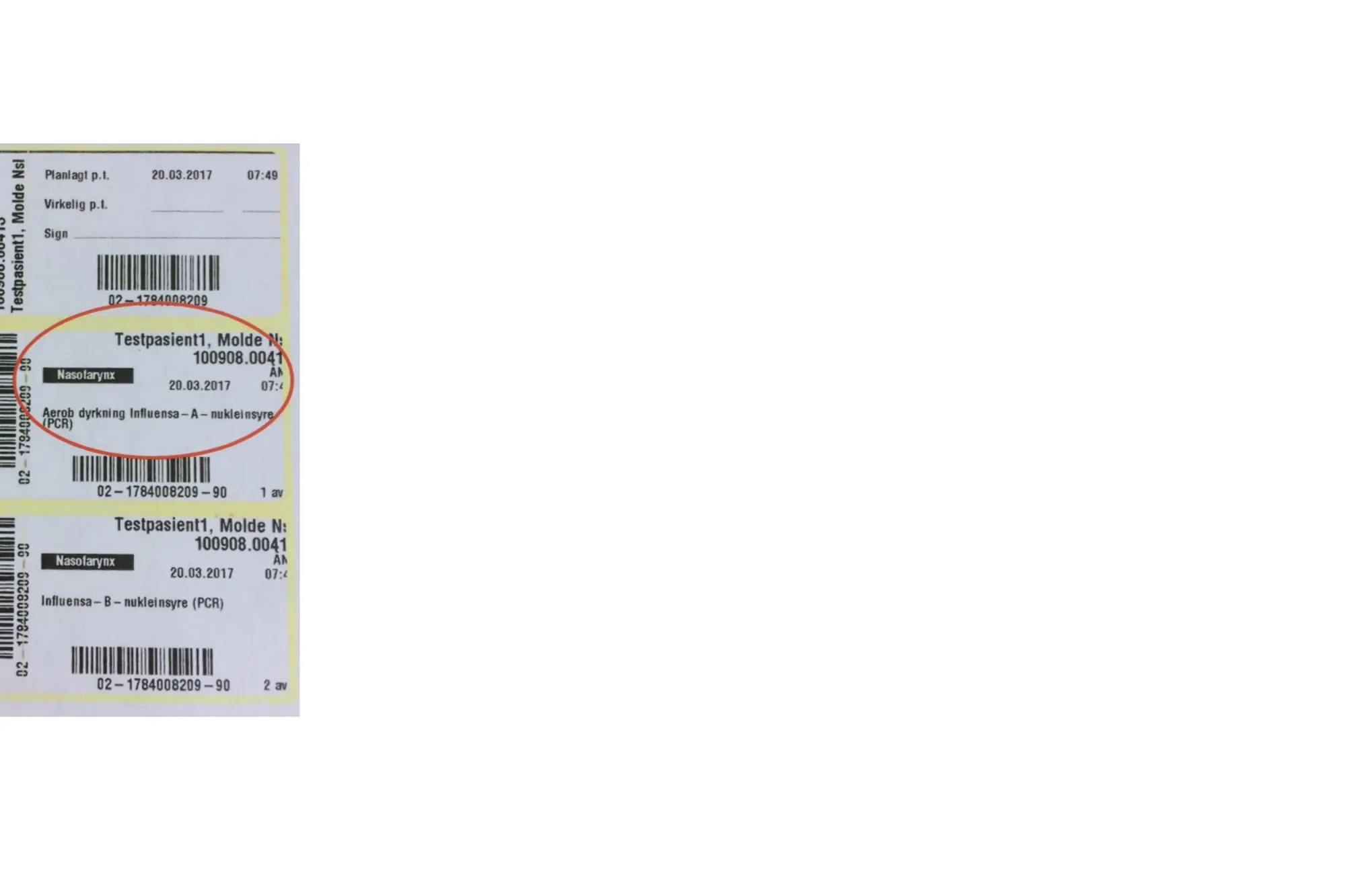 Eksempel på etikett for en luftveisprøve