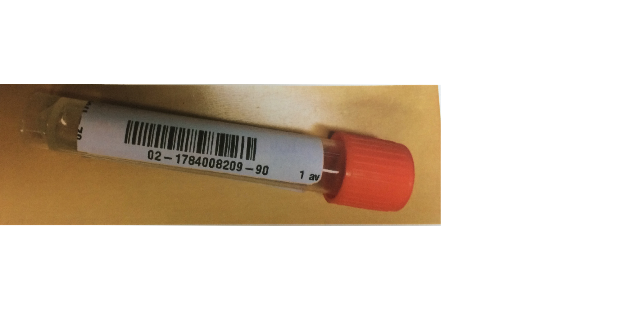 Eksempel på prøve med pasient-ID (testpasient), materiale, lesbar strekkode og svart markert tekstfelt. Bakside