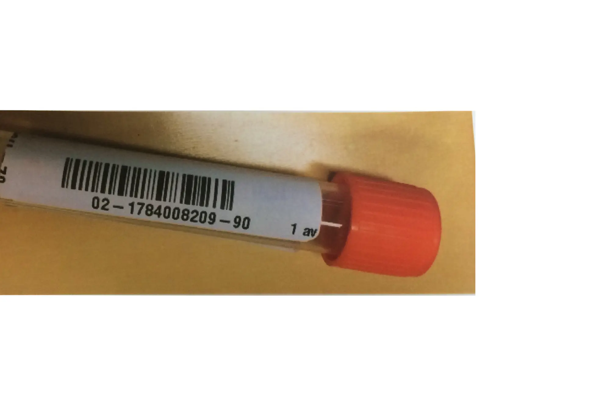 Eksempel på prøve med pasient-ID (testpasient), materiale, lesbar strekkode og svart markert tekstfelt. Bakside