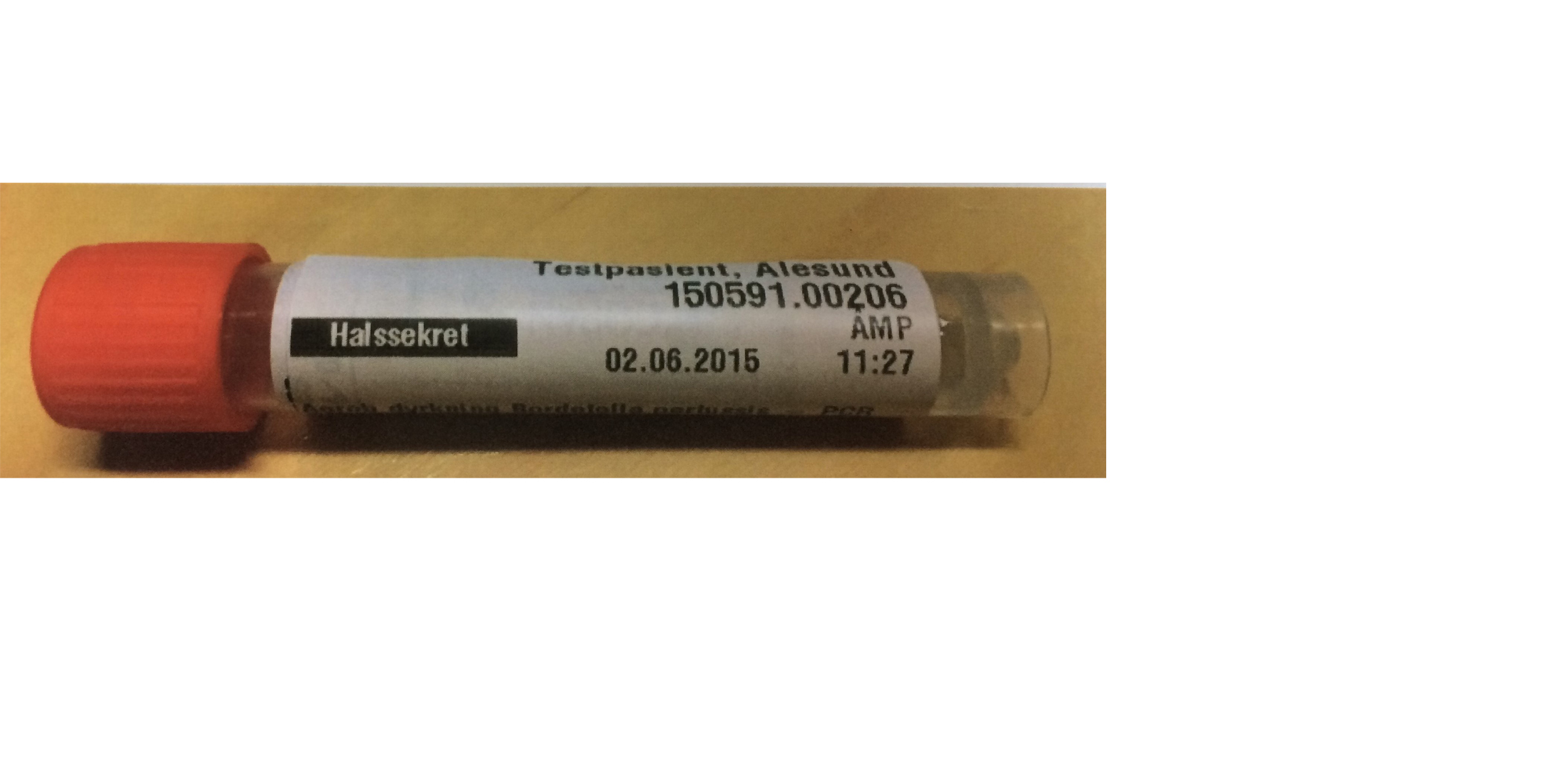 Eksempel på prøve med pasient-ID (testpasient), materiale, lesbar strekkode og svart markert tekstfelt. Fremside 