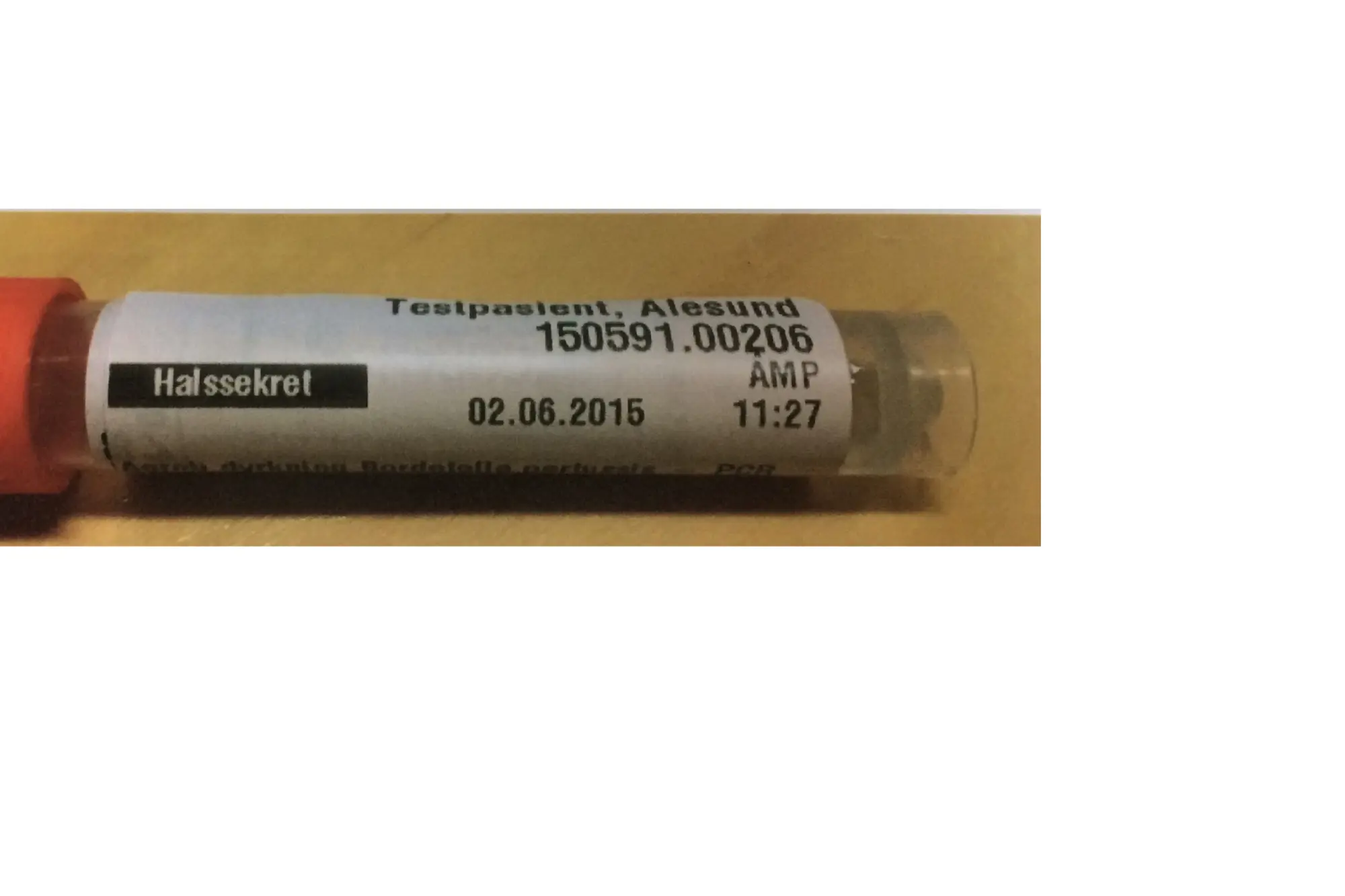 Eksempel på prøve med pasient-ID (testpasient), materiale, lesbar strekkode og svart markert tekstfelt. Fremside