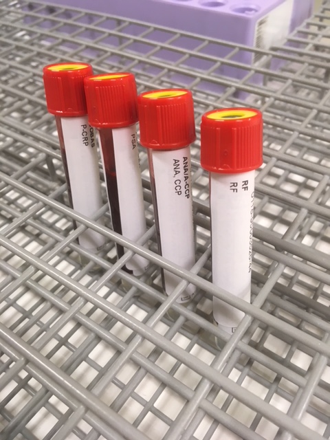 Gelrør ved prøvetaking