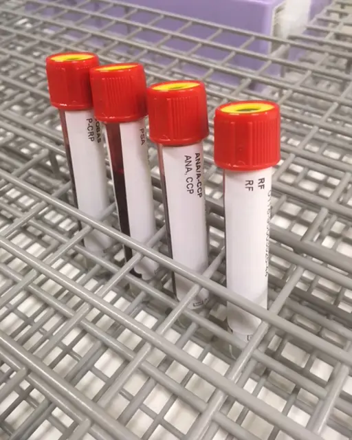 Gelrør ved prøvetaking