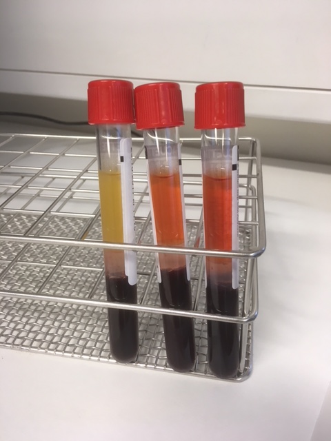Reagensrør frå laboratoriet