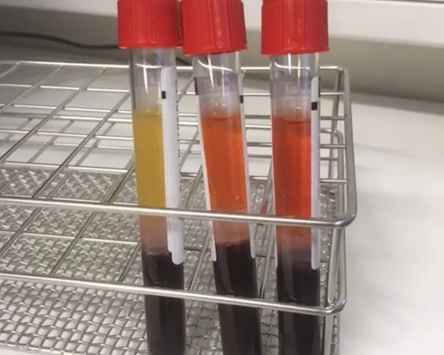 Reagensrør frå laboratoriet